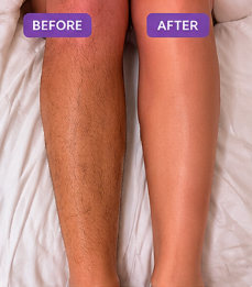 Ascend Culture™ SmoothSkin Hair Removal Mousse